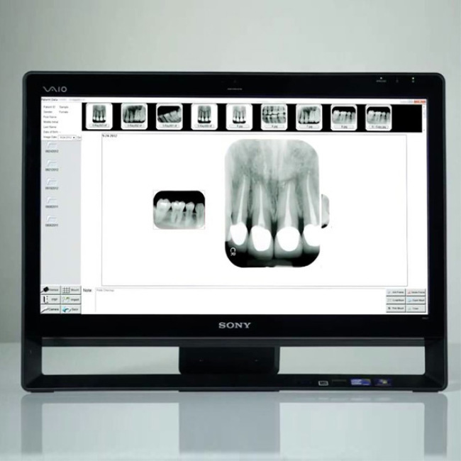 Original Apixia PSP Digital X-ray Dental 3D Scanner
